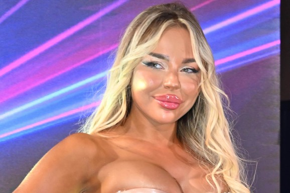 SOFIJU JANIĆIJEVIĆ PRE OPERACIJA LJUDI NE PREPOZNAJU! Uradila je toliko intervencija da je potpuno promenila fizionomiju lica: Šok transformacija