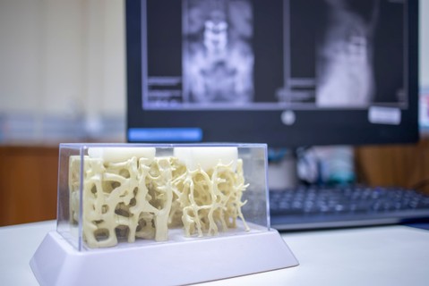 Ezért gyengülnek el a csontjaink! Nem kell beletörődni: így erősítheti meg akár 50 felett is