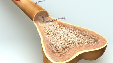 Czy hydrożel stanie się implantem kostnym przyszłości?