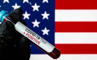 Koronawirus w USA: Rozpoczęły się szczepienia przeciw COVID-19 szczepionką Moderny