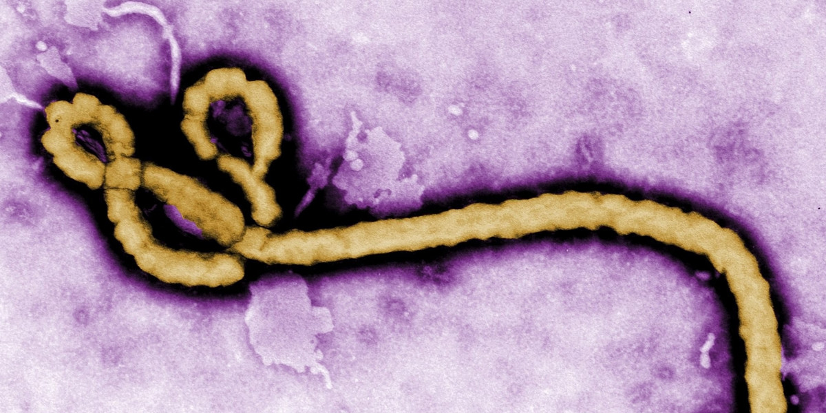 Wirus Ebola