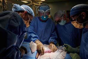 Transplantacja genetycznie zmodyfikowanej nerki świni pacjentowi ze śmiercią mózgu, podłączonemu do respiratora. Rodzina wyraziła zgodę na 54-godzinny eksperyment, operację przeprowadził zespół chirurgów z Langone Health w Nowym Jorku, 25 września 2021 r.