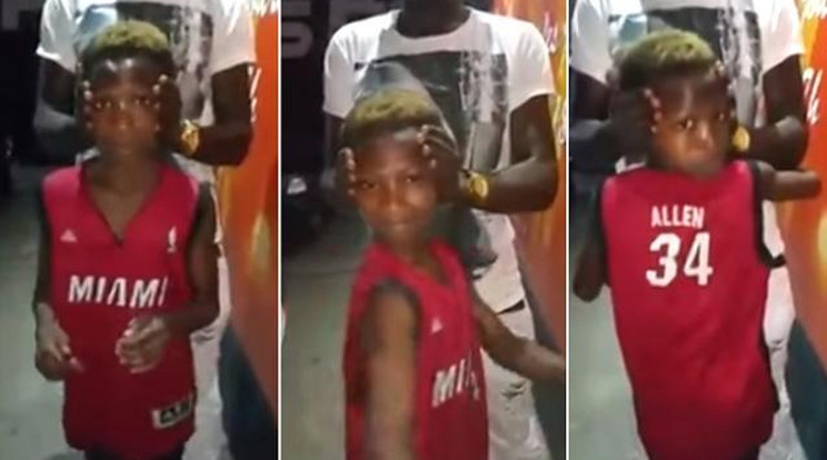 A videón látható fiú úgy hátra tudja fordítani a fejét 180 fokban, hogy a saját hátát is meg tudja nézni