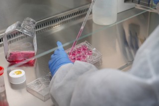 To jeden z najbardziej śmiertelnych patogenów dla ludzi. Jakie są objawy zakażenia?