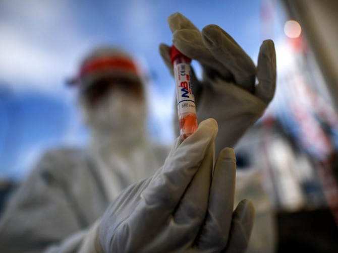 Evo kada je čovek pozitivan na korona virus najzarazniji