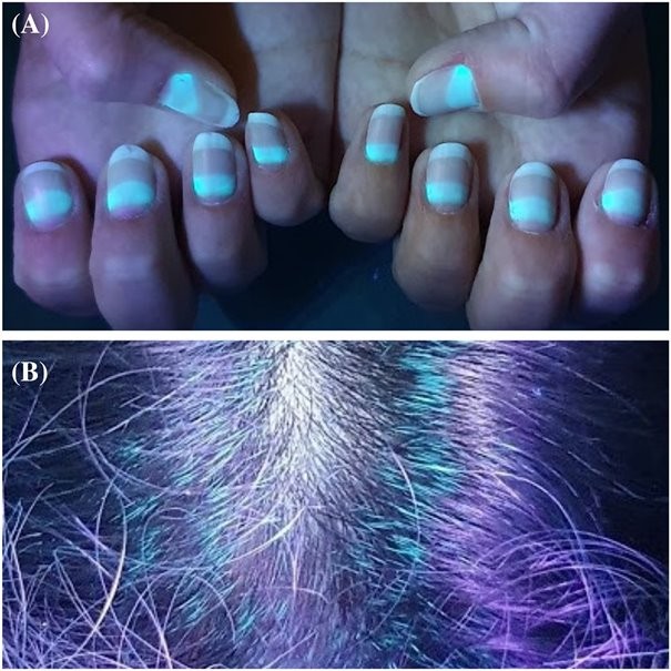 A körmök és a hajszálak is fluoreszkálnak