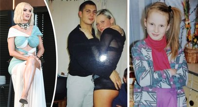 Iza Macudzińska tłumaczy się z zabiegów. "Dusiłam się, traciłam przytomność"