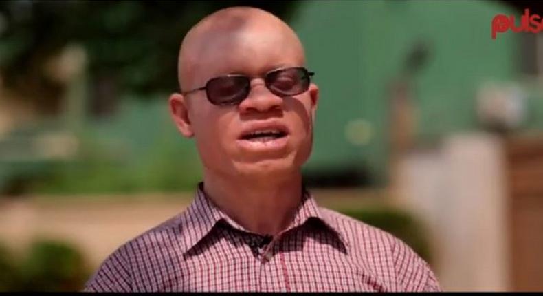 Akuamufie chiefs and elders drive away persons with albinism 