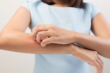Van amikor már a viszketéstől viszketünk - ezek lehetnek a kiváltó okok 