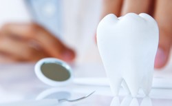 6 rzeczy, które musisz wiedzieć o implantach zębów