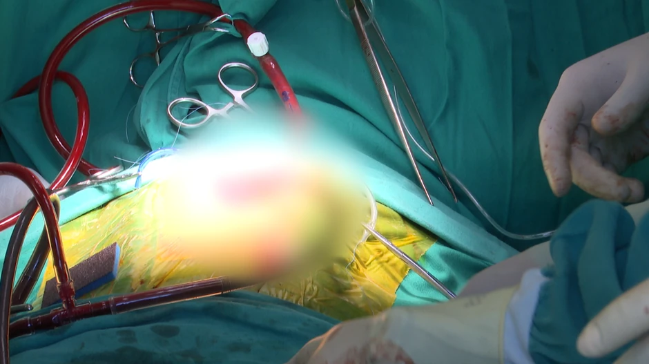 Operacija na Institutu za majku i dete