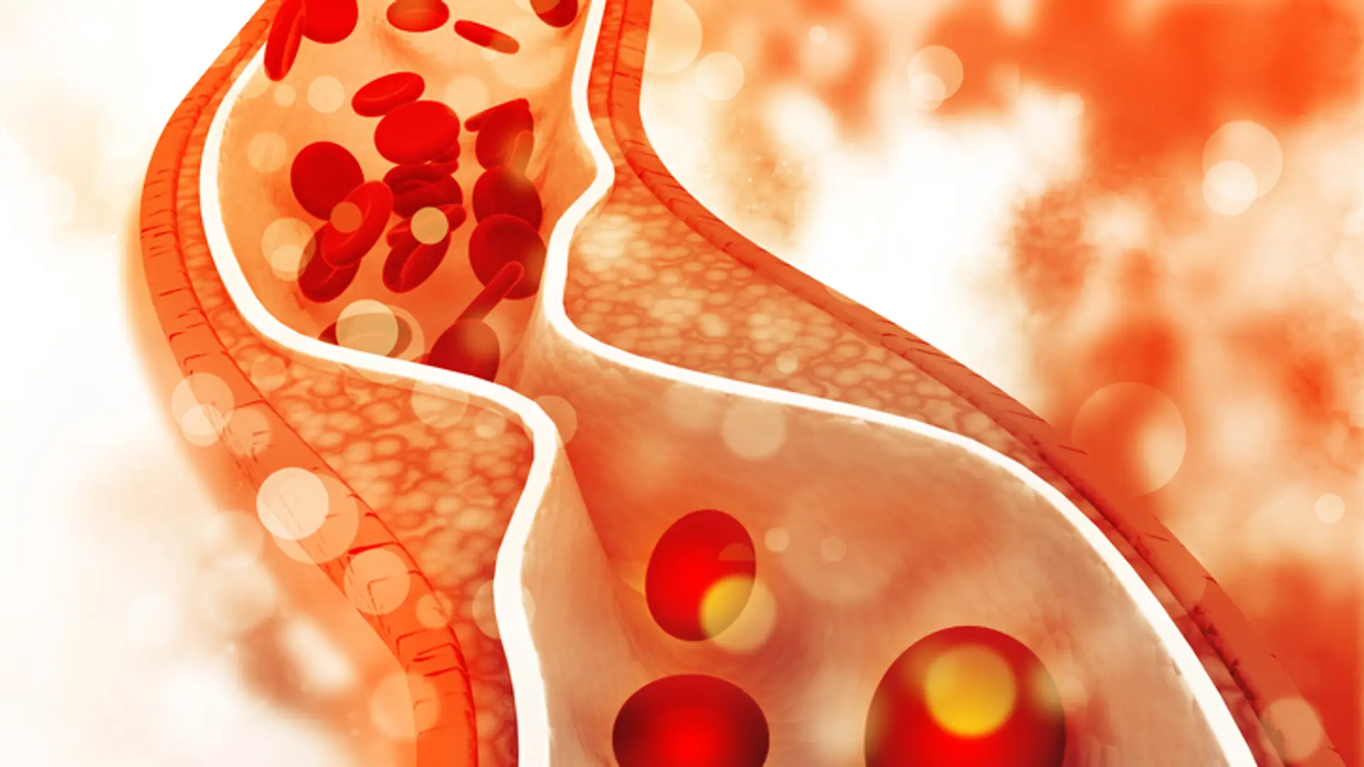 Cholesterol całkowity – czym jest?