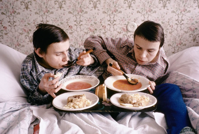 Sijamske bliznakinje Maša i Daša