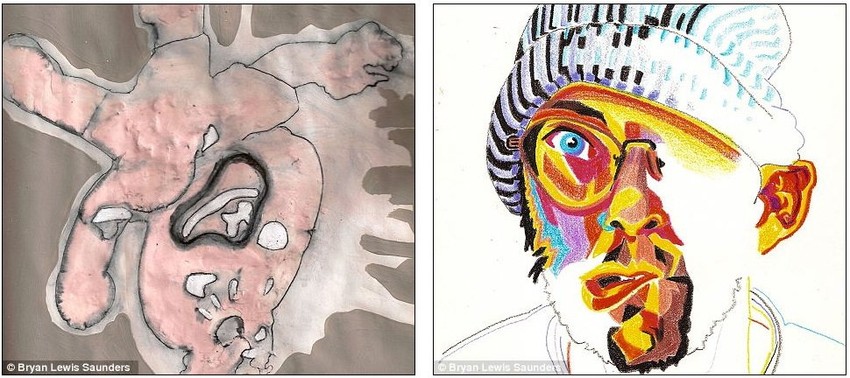 Levi crtež nastao je pod dejstvom aripiprazola, a desni pod dejstvom haloperidola