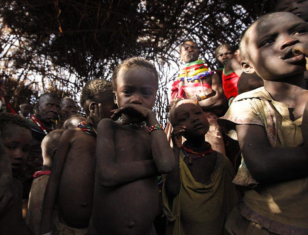 Somalia umiera. Nie tylko głód, ale też cholera