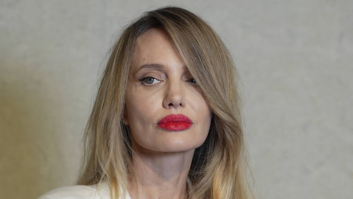 Novo lice Anđeline Džoli alarmiralo i doktore: "Da li je imala šlog?"