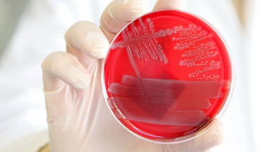 Rośnie liczba ofiar zakażonych groźną bakterią