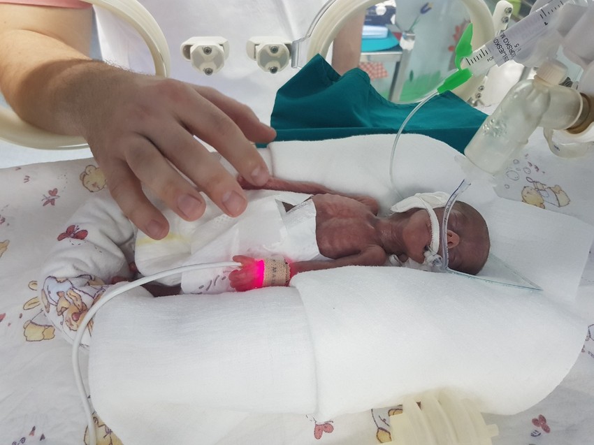 Najmanja srpska beba