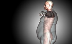 Te choroby powodują otyłość. Na nic odchudzanie?