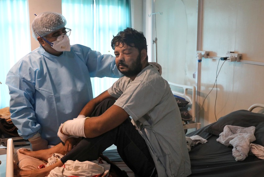 Epidemija crnih gljivica u Indiji - Gazijabad, Utar Pradeš