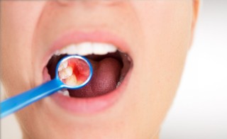 Czy koszty dentystyczne mogą być uznane za koszt uzyskania przychodu dla osoby prowadzącej działalność gospodarczą?