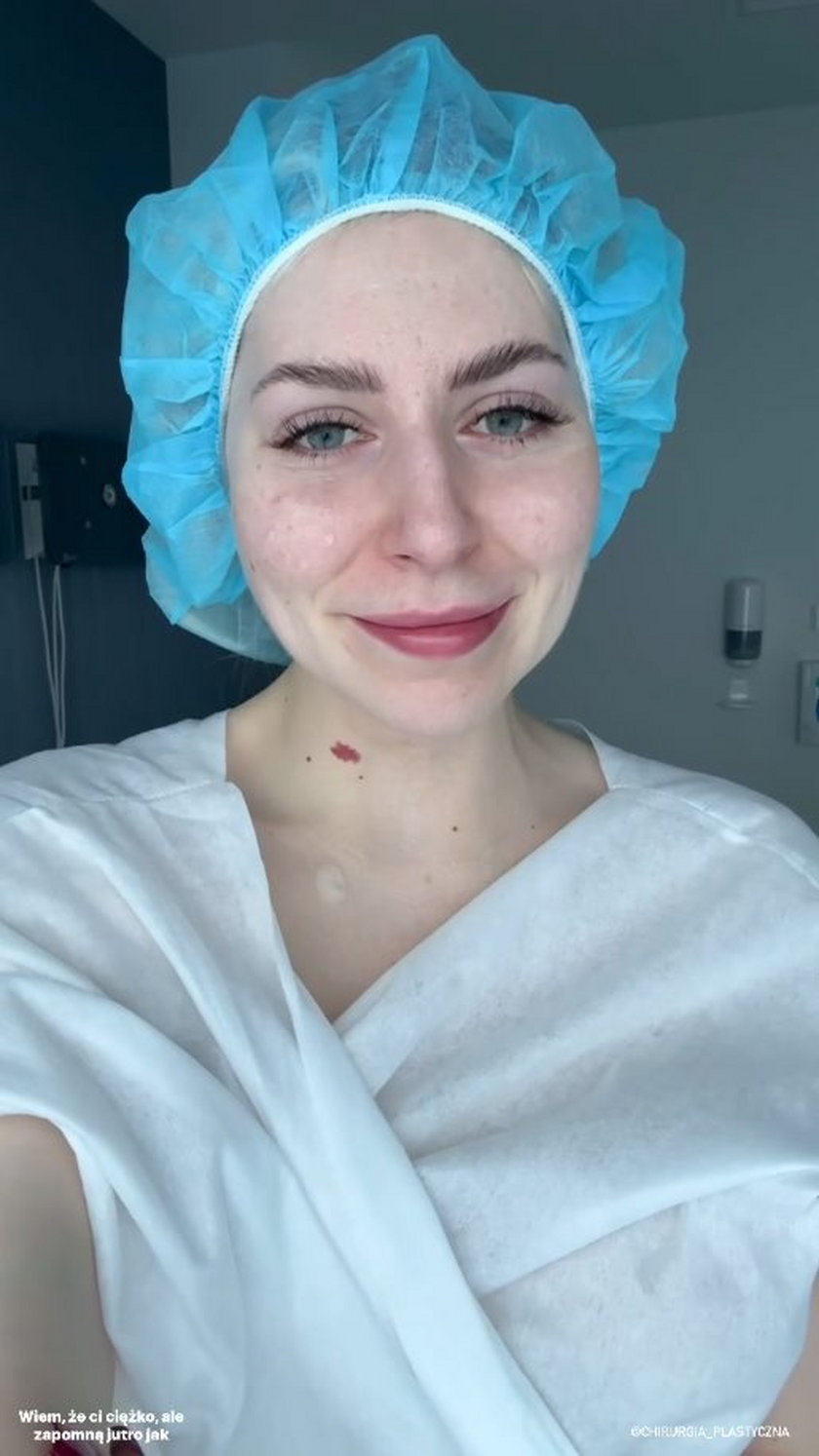 Julia Von Stein Pokazała Efekty Po Operacji Nosa Nie Widać Różnicy 2529