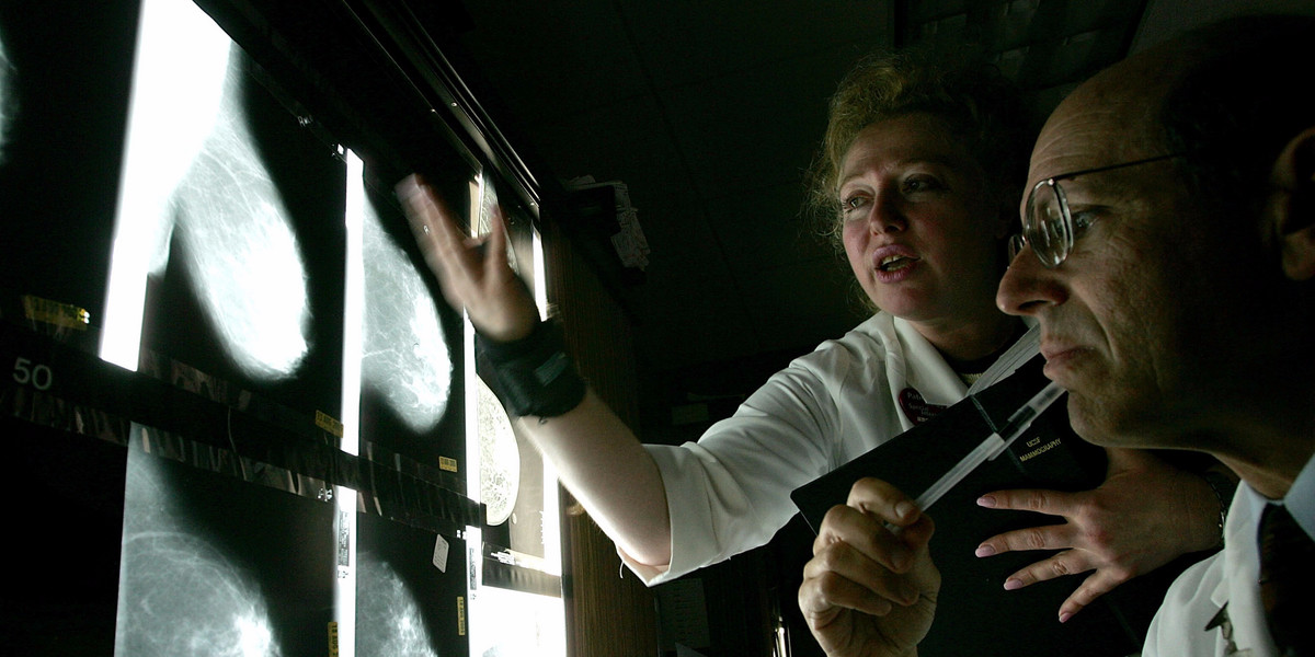 New major study: there's no need to stop mammograms based on age