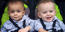 Te bliźnięta mają różne kolory skóry. Jak to możliwe?