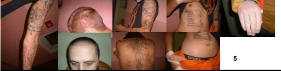 Tetovaže i ožiljci 