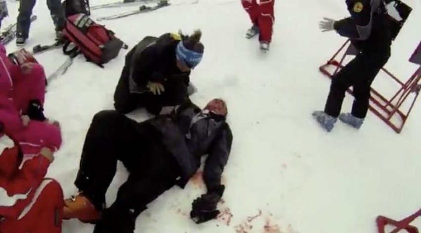 Stariji Dauling posle nesreće