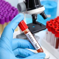 HbA1c érték a leleten: ha cukorbeteg, fontos, hogy nyomon kövesse!