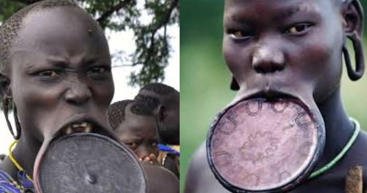 Lip stretching and removal of teeth by girls of the Mursi tribe before