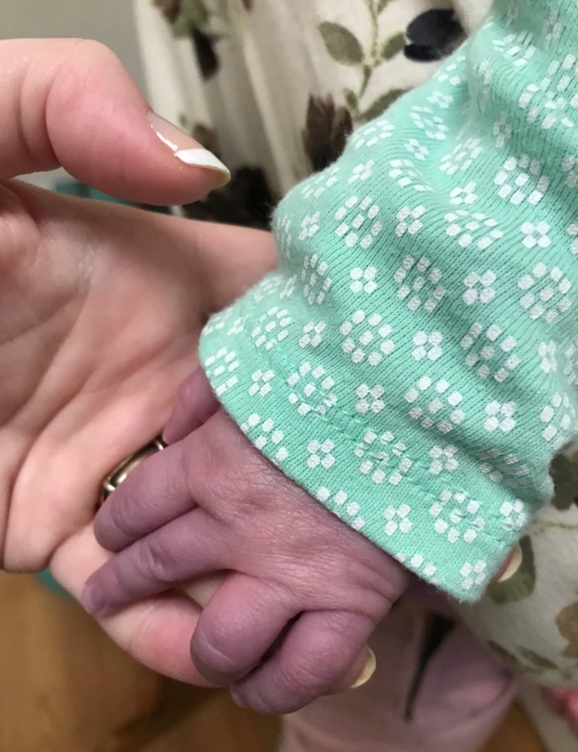Dłonie i stopy niemowlęcia stały się niebieskie. Wszystko przez koronawirusa 