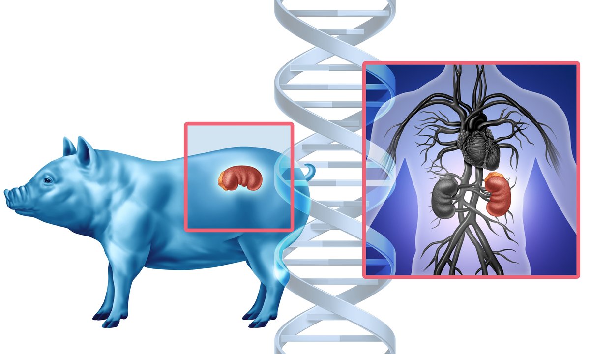 Świńskie nerki ratują życie. "Czuję się dobrze"