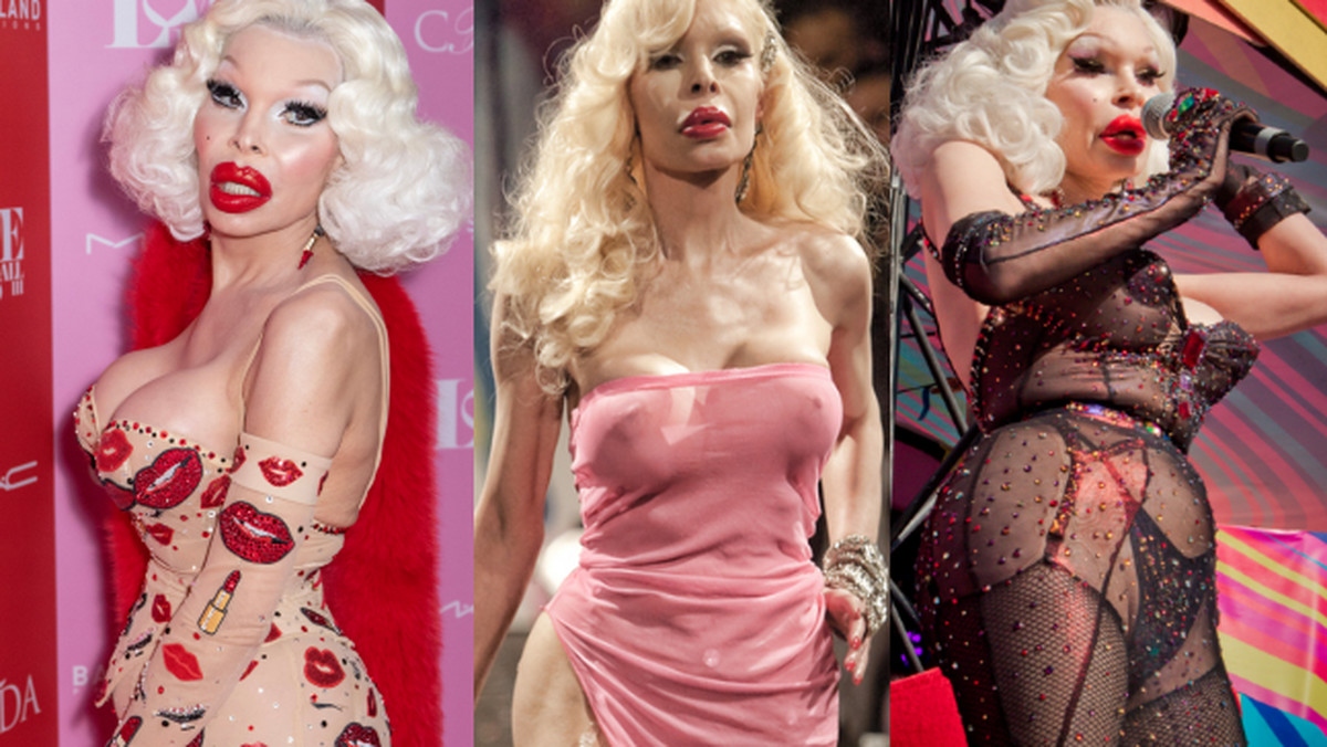 Amanda Lepore