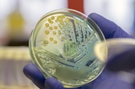 Microbiologist examining a multi-drug resistant coliform (Klebsiella pneumoniae) bacteria on CLED ag