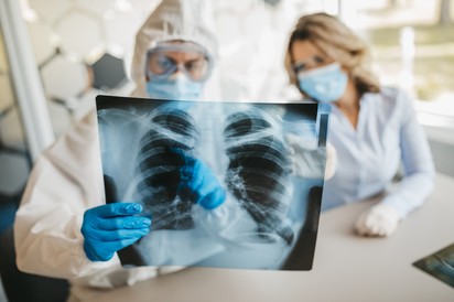 Koronavírus: ezzel a módszerrel  kideríthető, meggyógyult-e már a tüdő