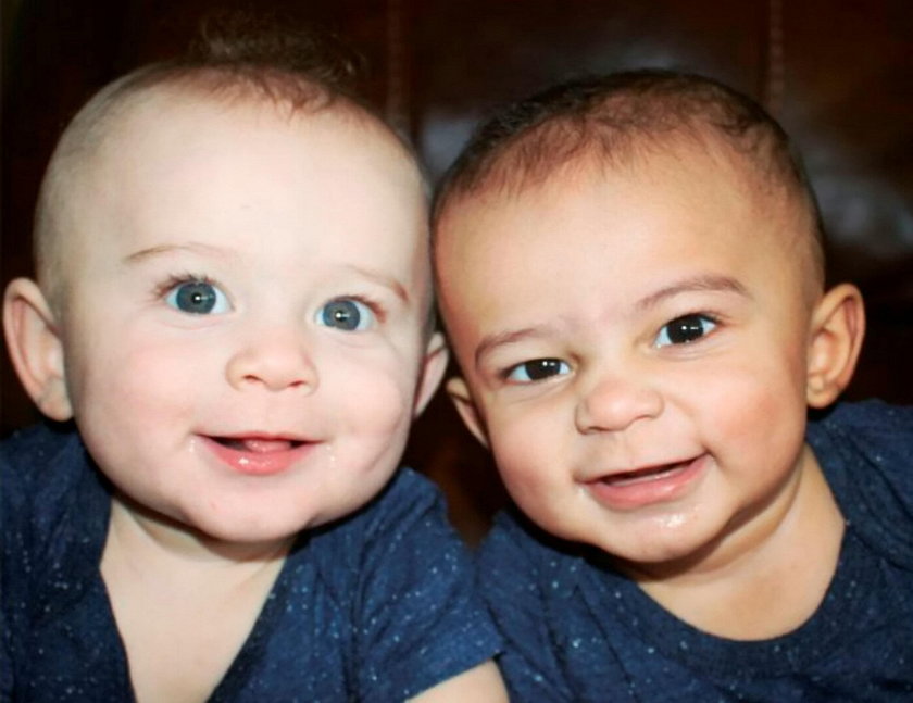 Te bliźnięta mają różne kolory skóry. Jak to możliwe?