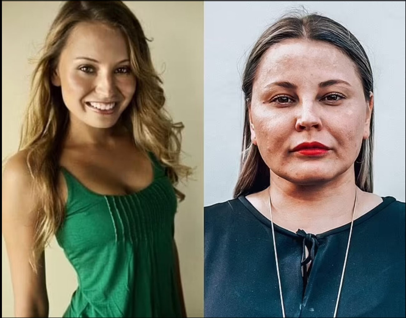 Anja (31) je bila zdrava i želela je da ima dete, onda je retka bolest ...