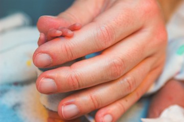 koraszülött, csecsemő, kisbaba, MRI, babamasszázs, fejlesztés