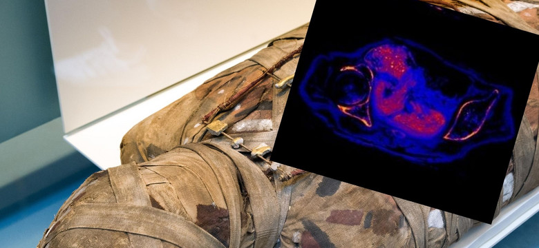 Pierwsza na świecie mumia ciężarnej kobiety. Odkrycie polskich naukowców