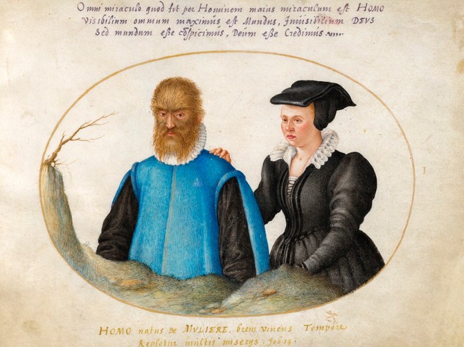 Petruš Gonsalvus