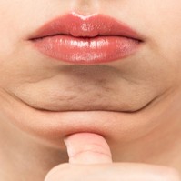 Mitől alakul ki a toka? Így lehet újra szép a nyakkontúrja