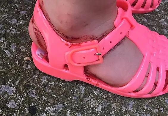 Kupujesz plastikowe buty dziecku na lato? Możesz zrobić mu krzywdę