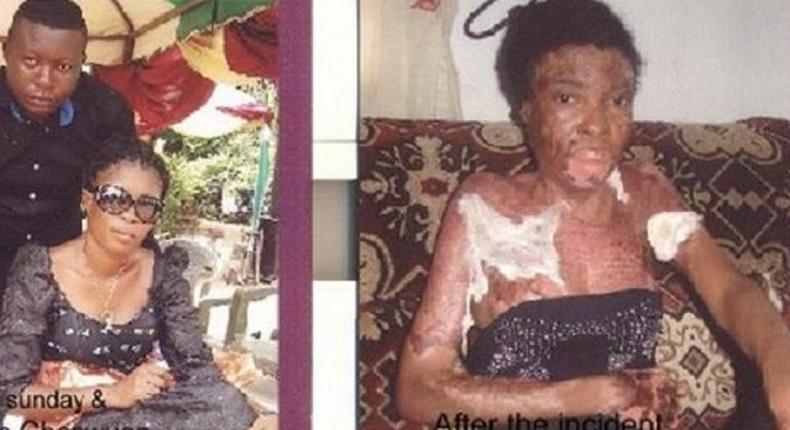 Isaac Gbarwuan and wife Mary Sunday before and after