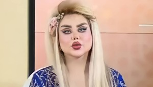 Dalia Naeem underwent 43 surgeries to look like Barbie [Instagram]