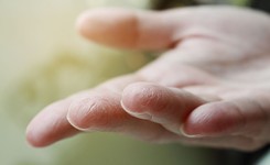 Wymazy ze skóry mogą wykrywać COVID-19