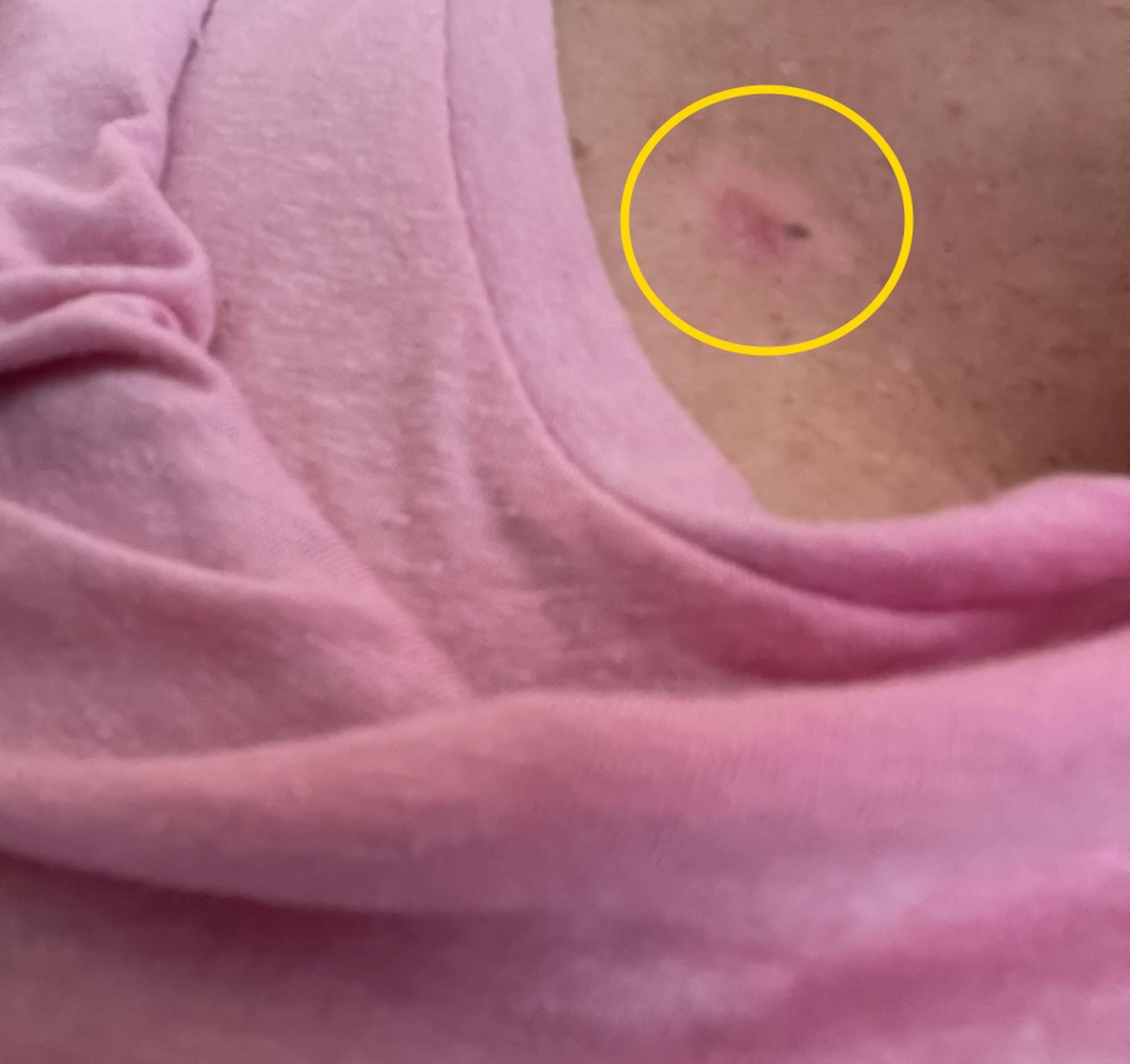 Rebecca Turner bojuje s rakovinou.