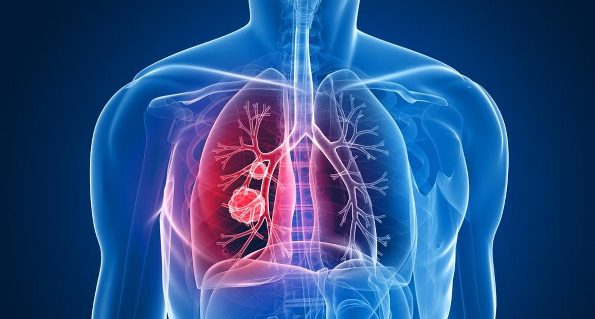 Płuca – budowa anatomiczna, najczęstsze choroby i funkcje w organizmie  [WYJAŚNIAMY]