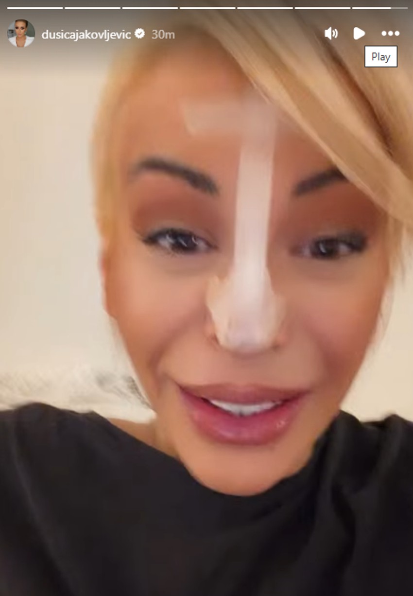 Dušica Jakovljević skroz oblepila nos flasterima, šokira: "Pao mi je vrh" nosa"